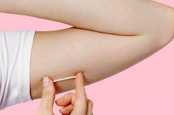 salud implantes