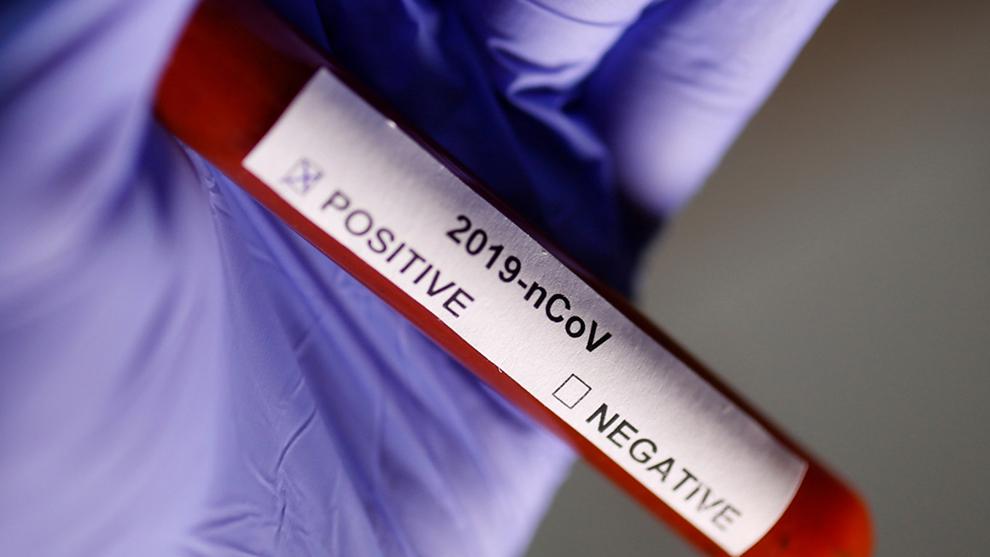 salud-analisis coronavirus